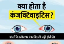 आंखों के जरिए फैल रही है ये संक्रामक बीमारी, यदि आपको भी है ऐसी समस्या तो हो जाइए Alert……..