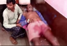 चारा लेने गए किसान पर बाघ ने किया हमला, अस्पताल में भर्ती, गांव में दहशत