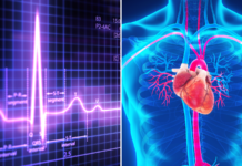 हृदय रोग विशेषज्ञ की सलाह, हृदय की पंपिंग क्षमता 50 प्रतिशत से कम, तो जल्द शरू करें इलाज