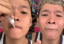 लड़के ने अपने होंठों पर लगाया Fevi Kwik